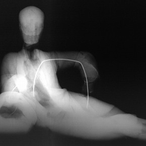 Figure 2. X-ray of the unfired clay figure (Museum No. FE 24-1999). X-ray by Paul Robins, V