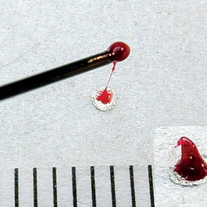 Figure 1. Making of ‘artificial’ rubies using a hot needle and stained turpentine resin (Photography by Timea Tallian)