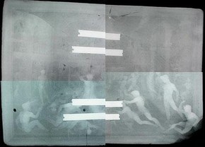 Figure 1. X-Ray montage (Photography by Victor Borges)