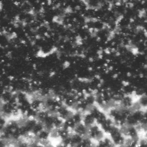 Figure 2. The dot matrix of an injet print. The ink is distributed in a random pattern to create the image with differently coloured dots lying next to each other. (magnification x60 approx.)