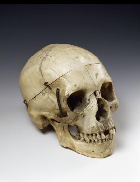 This human skull was given to the French actress Sarah Bernhardt (1844-1923) by the novelist Victor Hugo, after she triumphed in his historical drama Hernani in 1877 © Victoria and Albert Museum, London