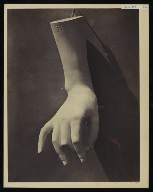 42591 Albumen print of the cast of a hand by Adolphe Bilordeaux
